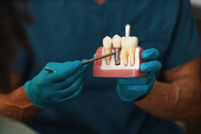 A dentist in blue gloves holds a dental model showing a tooth implant. The setting is clinical, conveying professionalism and care.